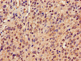 CSB-PA018659LA01HU