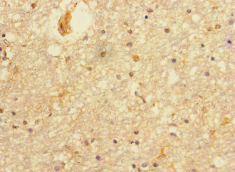 CSB-PA018733LA01HU