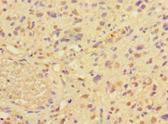 CSB-PA018733LA01HU