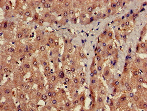 CSB-PA018742LA01HU