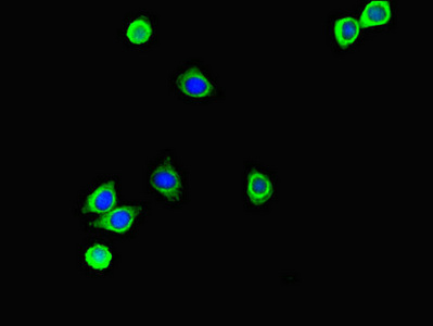 CSB-PA020645LA01HU