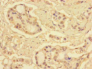 CSB-PA020645LA01HU
