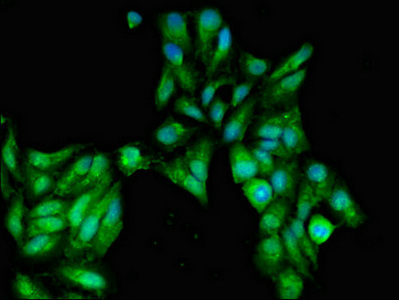 CSB-PA021139LA01HU