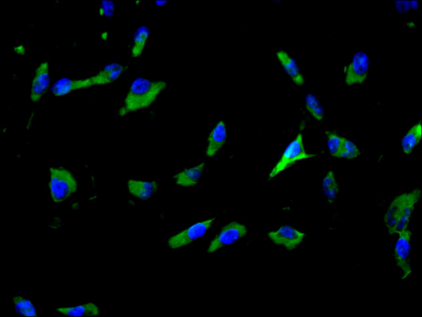 CSB-PA021335LA01HU