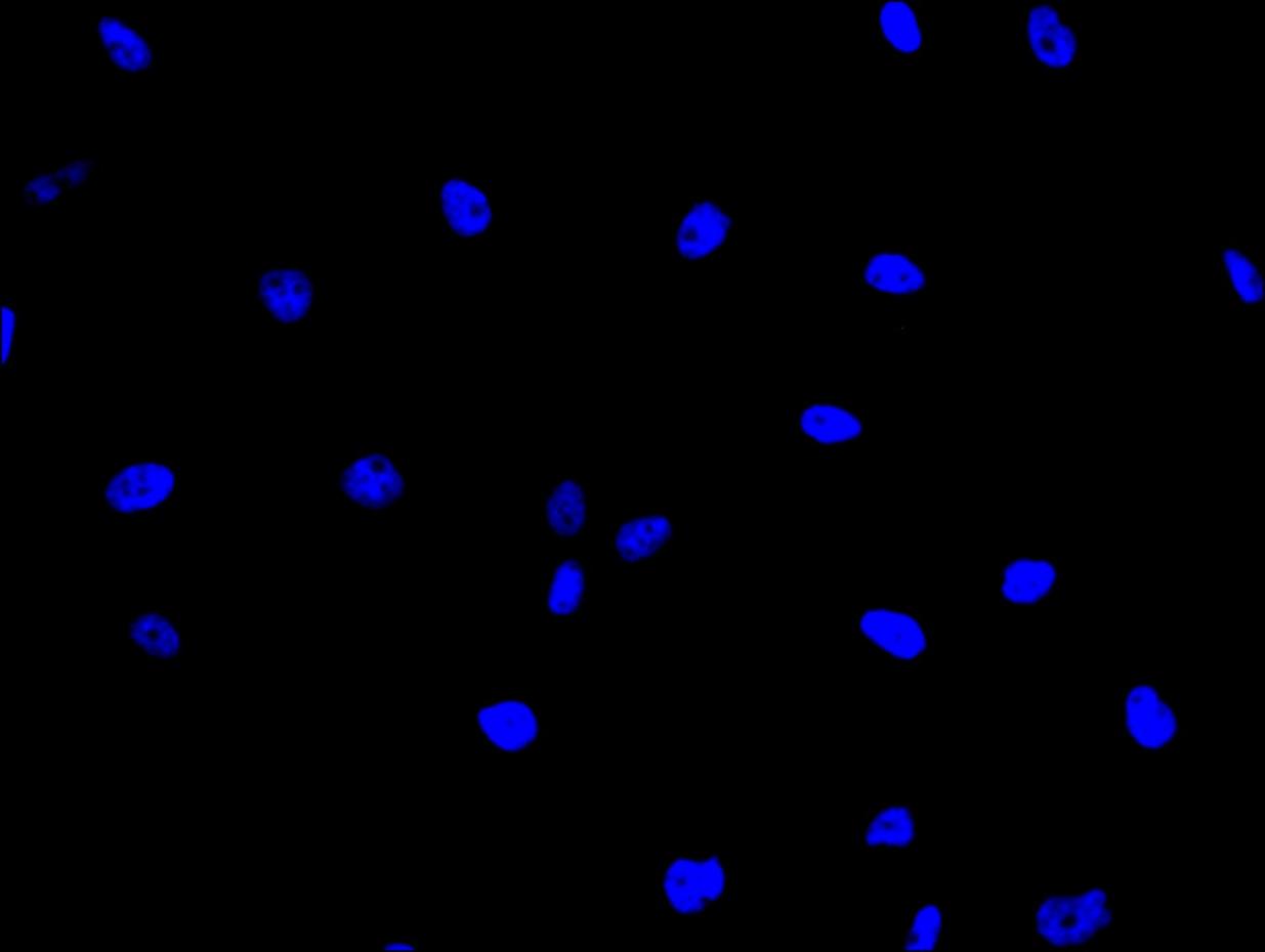 CSB-PA021335LA01HU