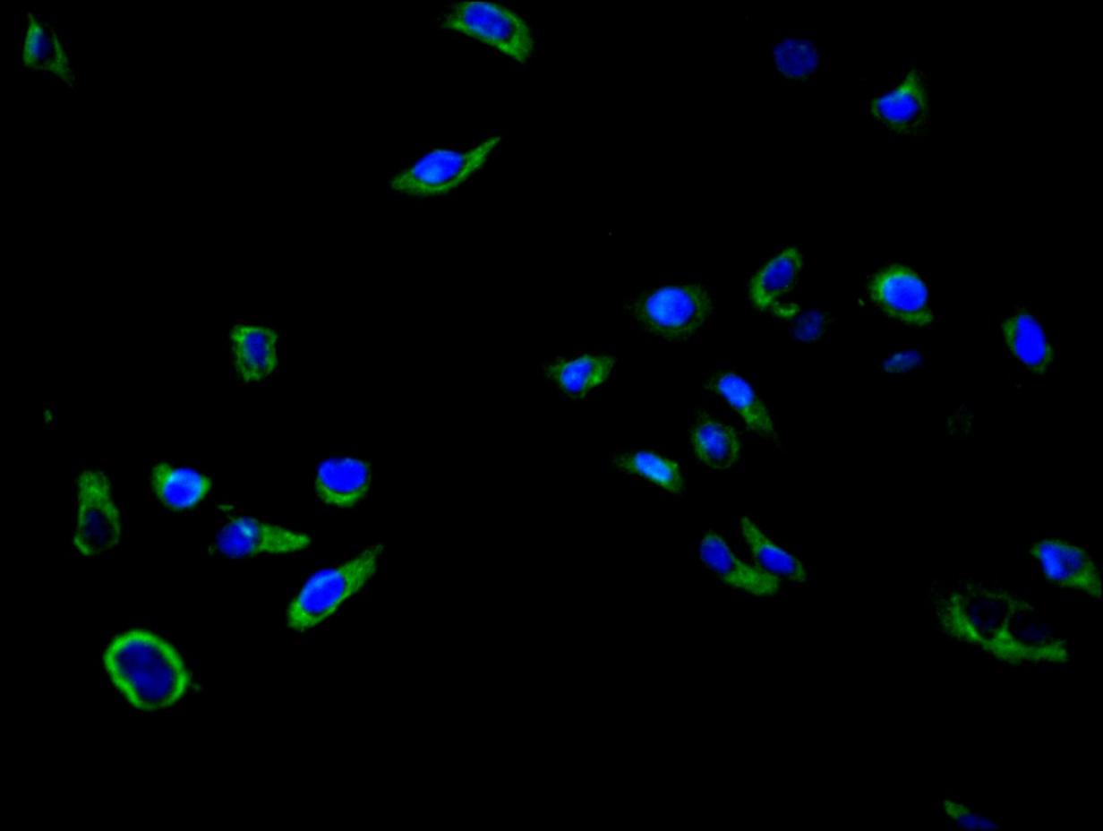 CSB-PA021335LA01HU