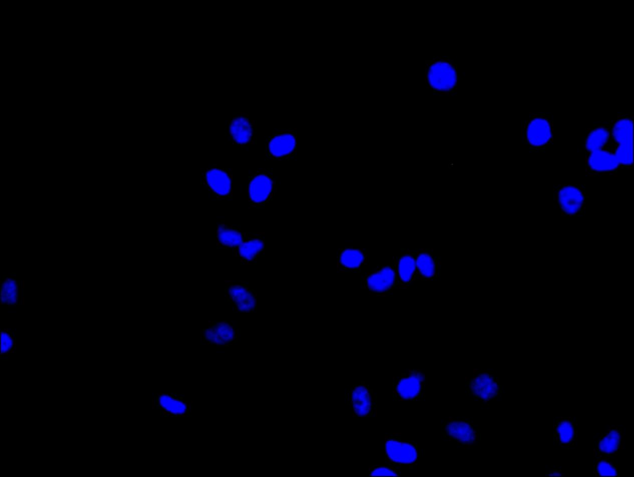 CSB-PA021335LA01HU