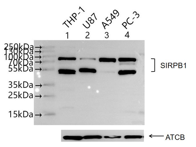 CSB-PA021335LA01HU