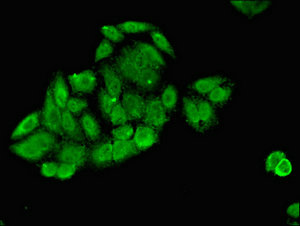 CSB-PA021475LA01HU