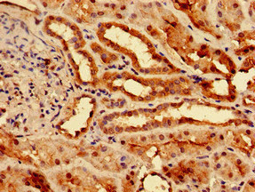 CSB-PA021475LA01HU