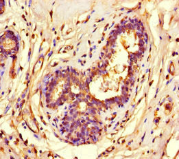 CSB-PA022972LA01HU