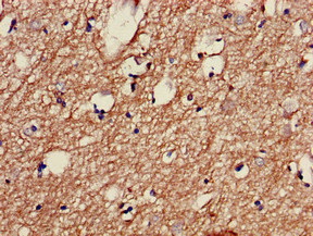 CSB-PA023470LA01HU