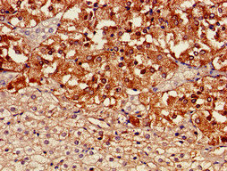 CSB-PA023470LA01HU