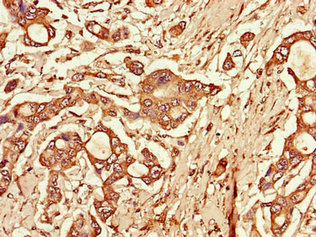 CSB-PA023602LA01HU