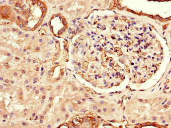 CSB-PA023602LA01HU