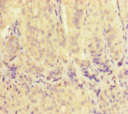 CSB-PA025824LA01HU