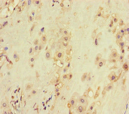CSB-PA025824LA01HU