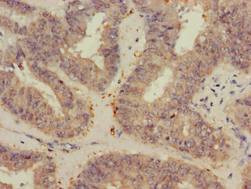 CSB-PA025834LA01HU