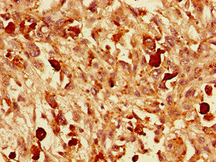 CSB-PA025847LA01HU