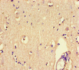 CSB-PA613393LA01HU