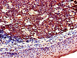 CSB-PA615672LA01HU