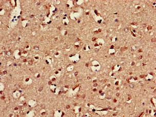 CSB-PA615672LA01HU