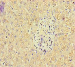 CSB-PA681391LA01HU