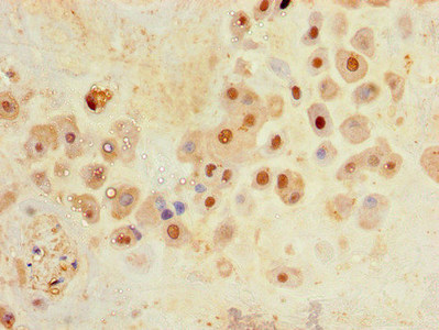 CSB-PA818247LA01HU