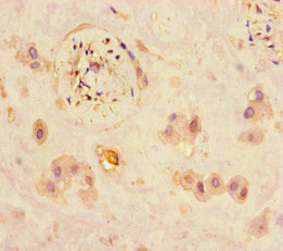 CSB-PA852915HA01HU