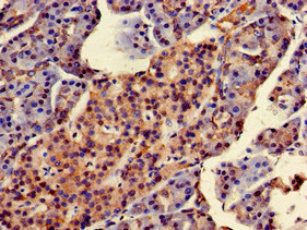 CSB-PA853100LA01HU