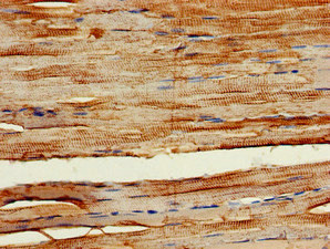 CSB-PA854108LA01HU