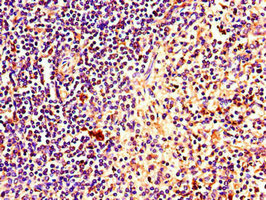 CSB-PA863144LA01HU