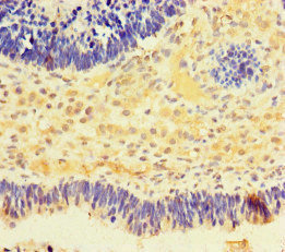 CSB-PA866332HA01HU