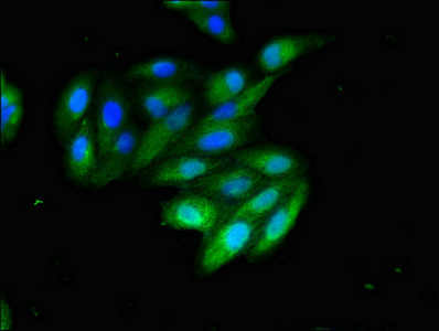 CSB-PA873604LA01HU