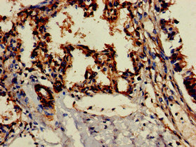 CSB-PA873604LA01HU