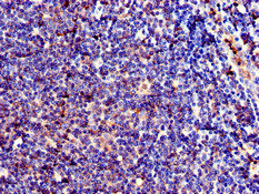 CSB-PA873604LA01HU