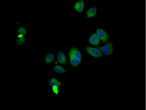 CSB-PA875720LA01HU
