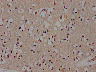 CSB-PA880159HA01HU