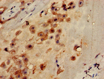 CSB-PA883623LA01HU
