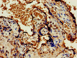 CSB-PA885708LA01HU