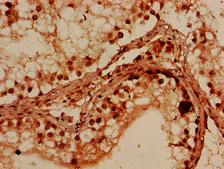 CSB-PA885738LA01HU