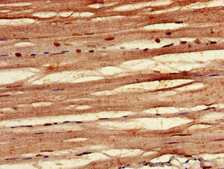 CSB-PA892132LA01HU