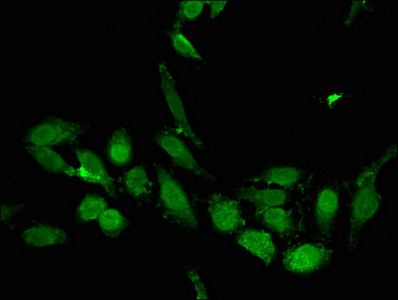 CSB-PA896743LA01HU