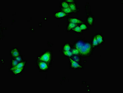 CSB-PA001257ESR2HU