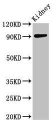 CSB-PA001311LA01HU