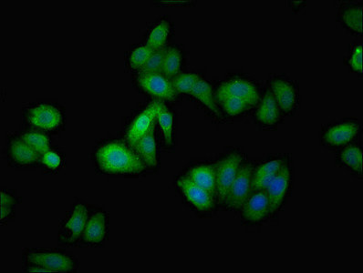 CSB-PA001463ESR2HU