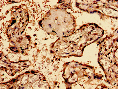 CSB-PA002683EA01HU