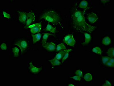 CSB-PA005086DA01HU