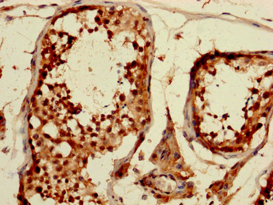 CSB-PA005086DA01HU