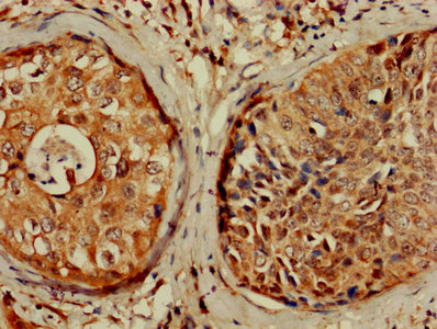 CSB-PA005086DA01HU